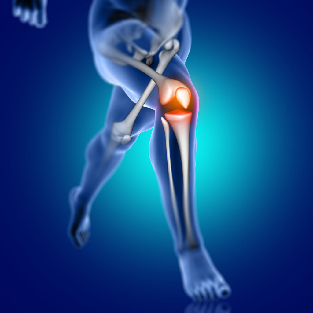 osteoarthritis (OA) and rheumatoid arthritis (RA)