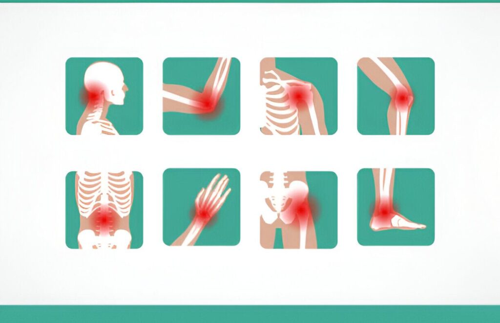 Symptoms of Polymyalgia Rheumatica