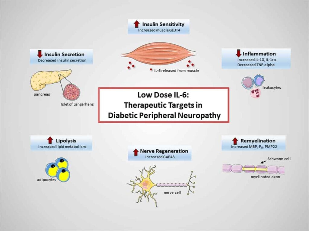 Diabetic Peripheral Neuropathy