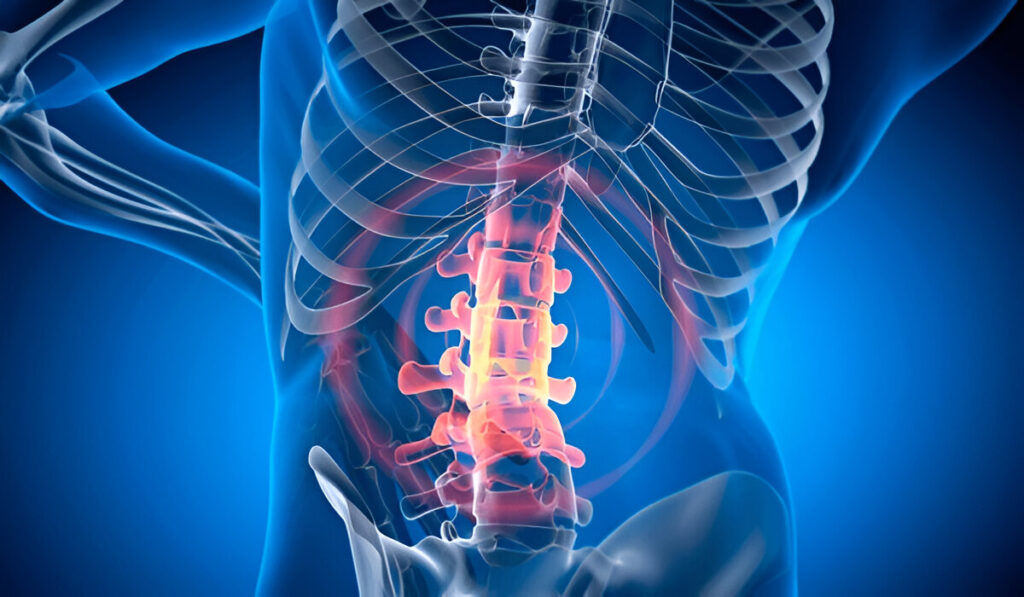 X-ray 3D Illustration of a man with strong pain in back with dark blue background - Arthritis in the spine