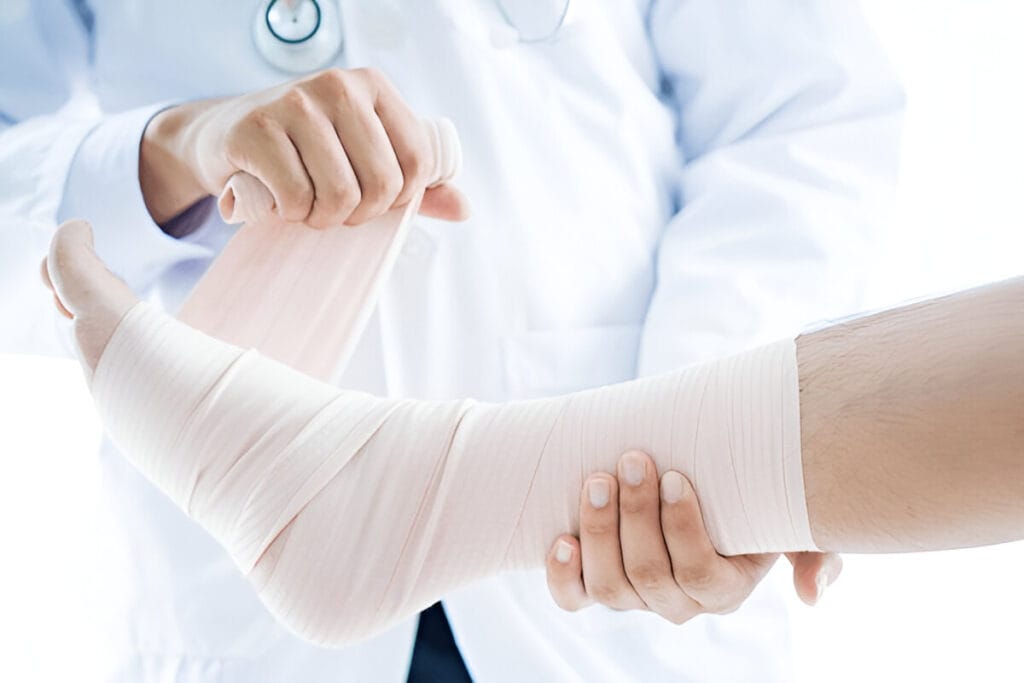 bandaging foot of patient at doctor's office. One of the method to heal the sprained ankle